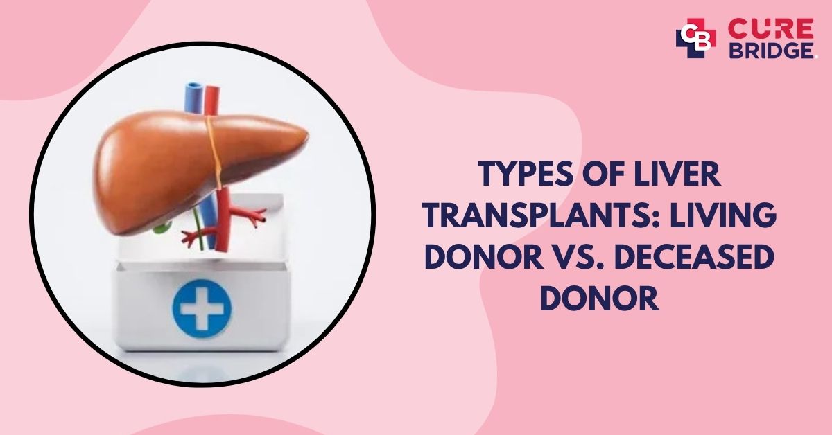 Types of Liver Transplants: Living Donor vs. Deceased Donor 