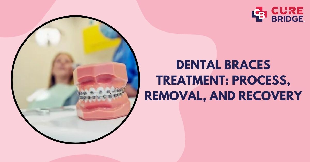 Dental Braces Treatment: Process, Removal, and Recovery