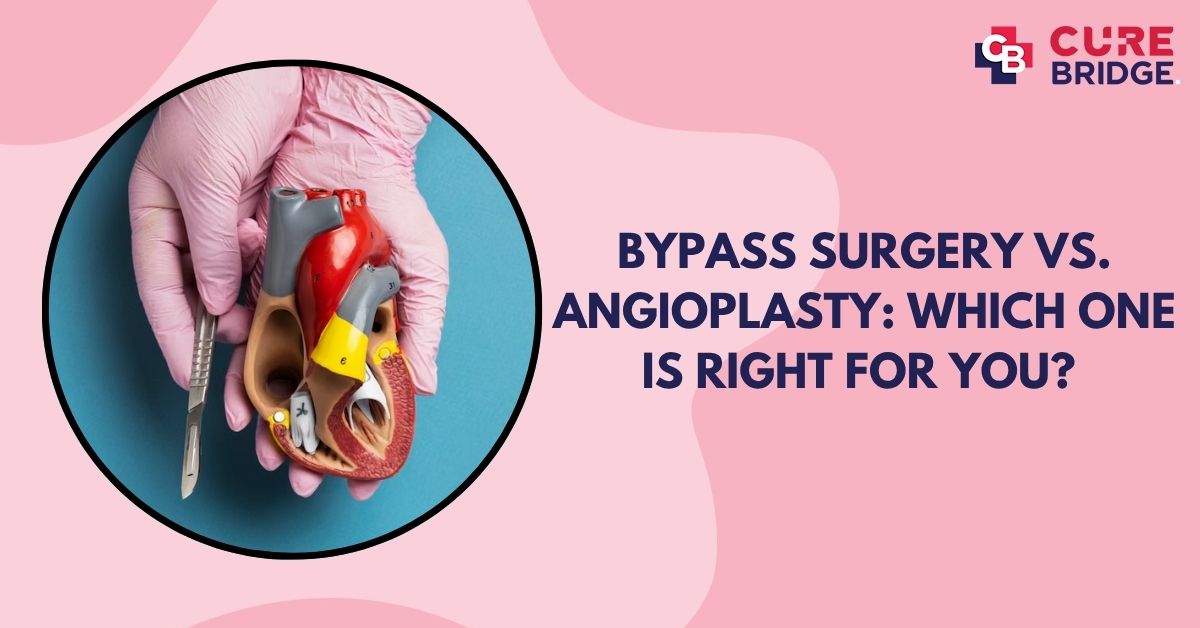 Bypass Surgery vs. Angioplasty: Which One is Right for You?