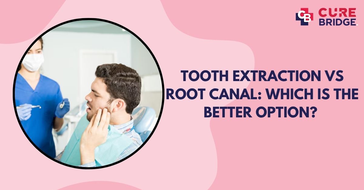 Tooth Extraction vs Root Canal: Which is the Better Option? 