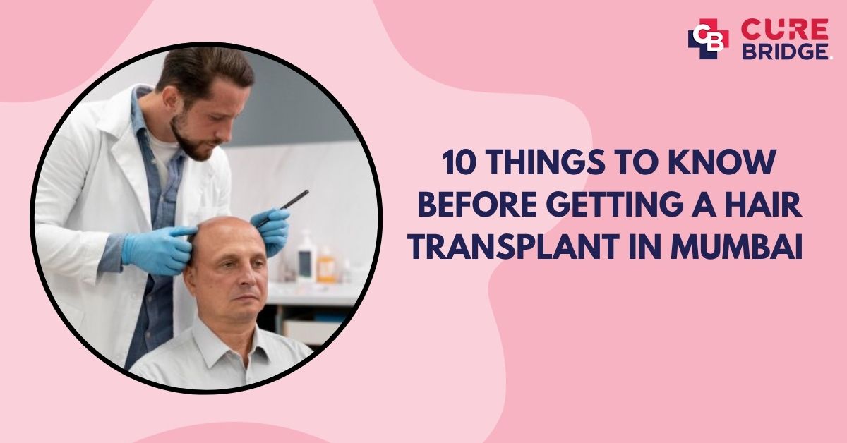 10 Things to Know Before Getting a Hair Transplant in Mumbai 