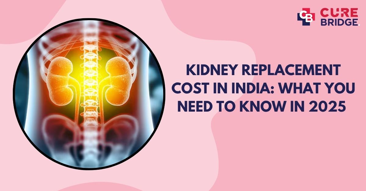 Kidney Replacement Cost in India: What You Need to Know in 2025