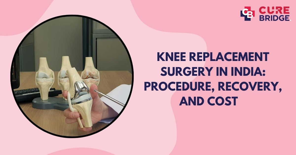 Knee Replacement Surgery in India: Procedure, Recovery, and Cost   