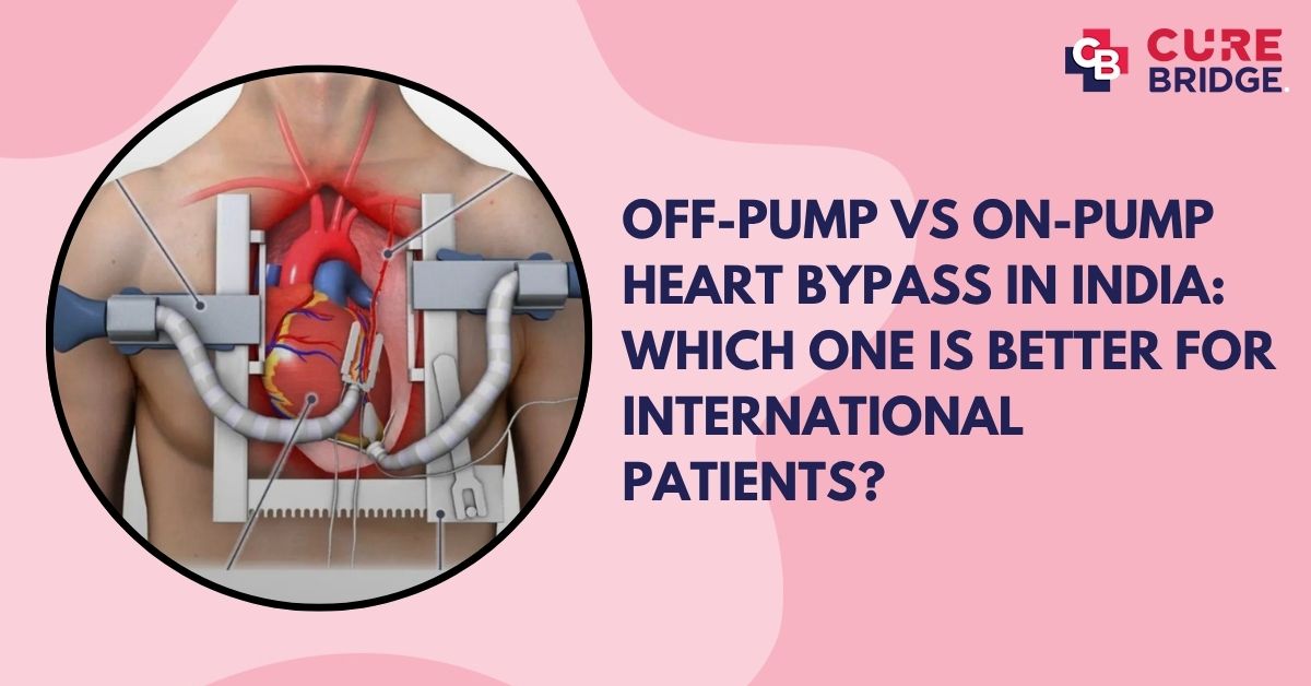 Off-Pump vs On-Pump Heart Bypass in India: Which One Is Better for International Patients?