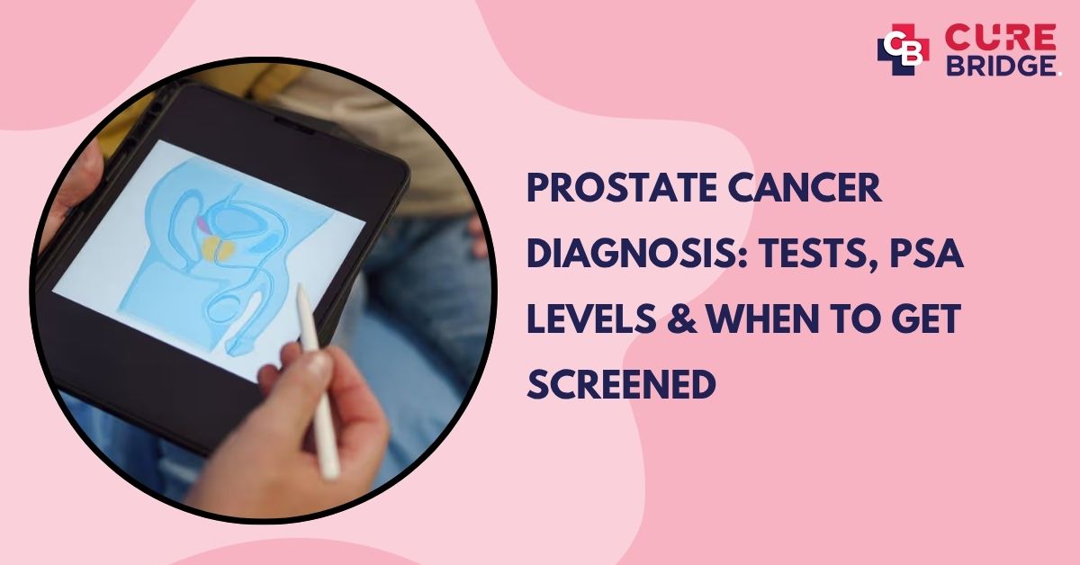 Prostate Cancer Diagnosis: Tests, PSA Levels & When to Get Screened