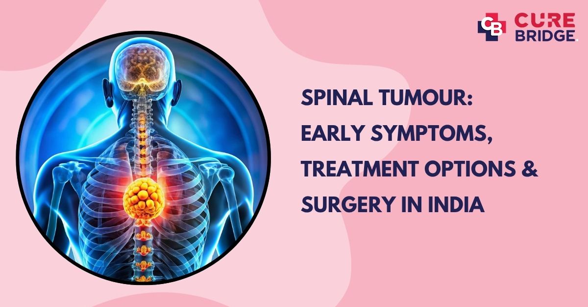 Spinal Tumour: Early Symptoms, Treatment Options & Surgery in India