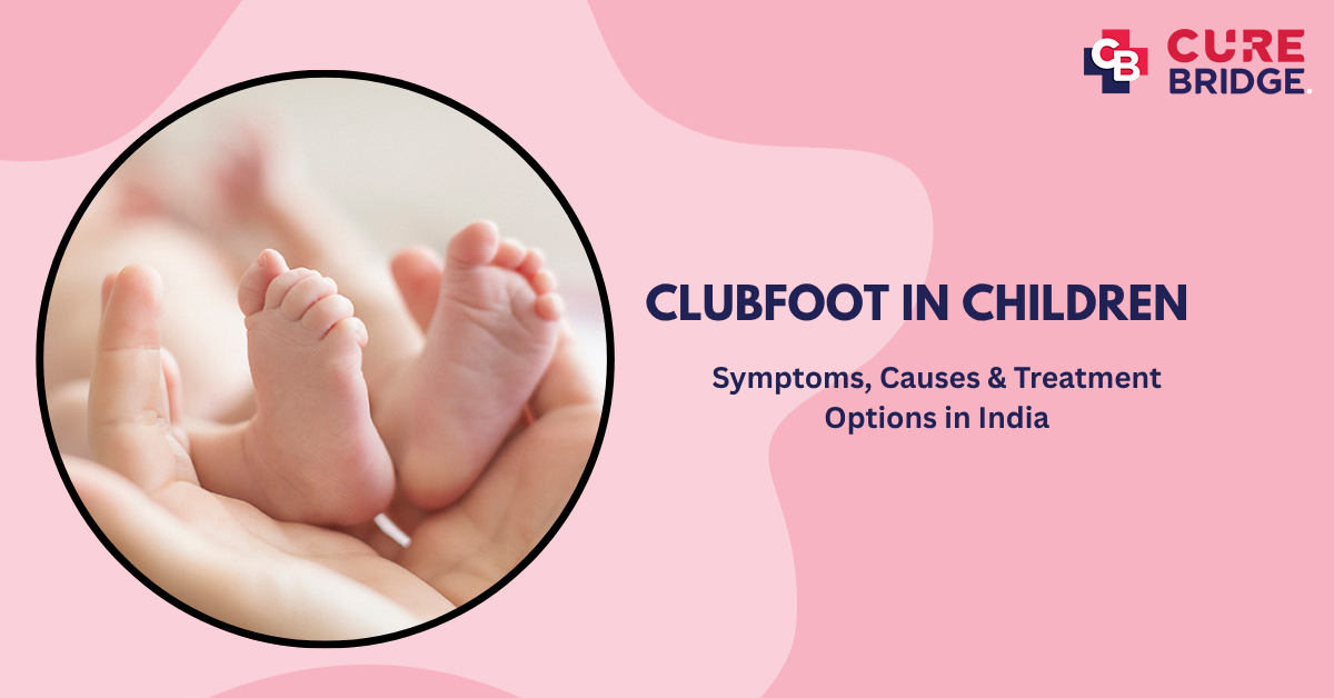 Clubfoot in Children: Symptoms, Causes & Treatment Options in India