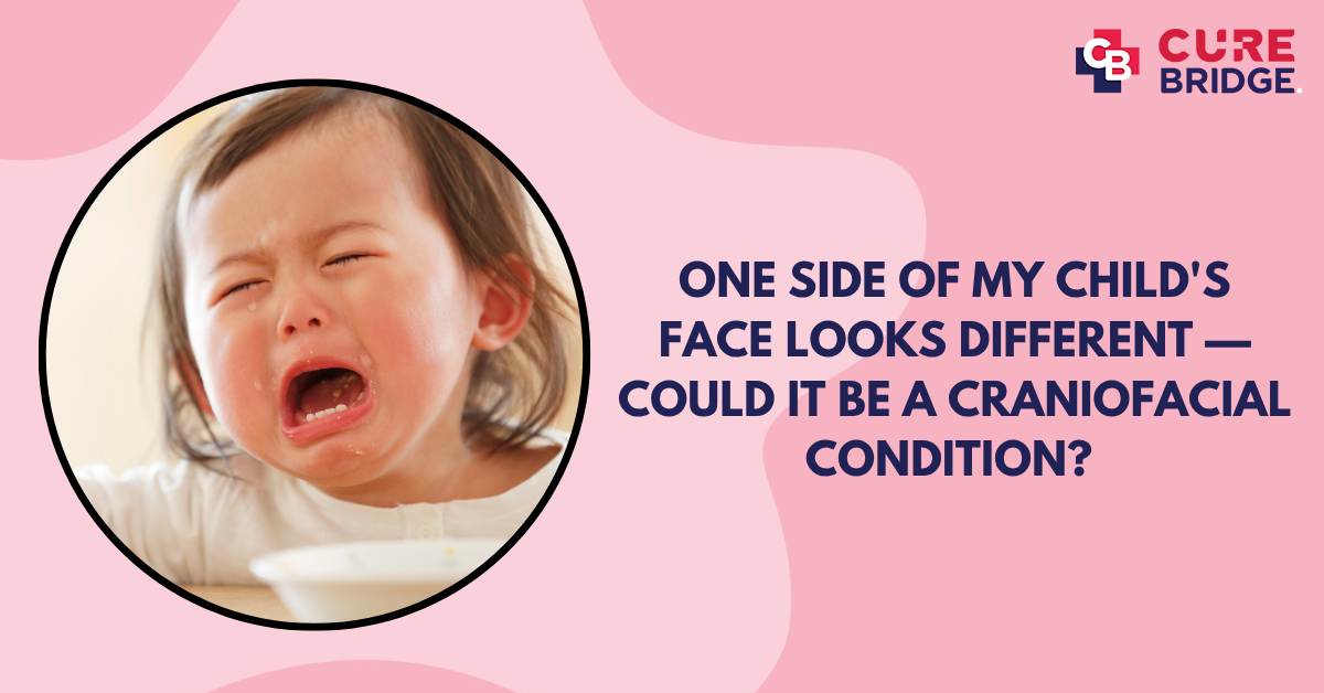 One Side of My Child’s Face Looks Different — Could It Be a Craniofacial Condition?